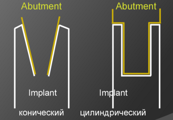 Abutment